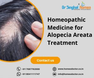 If you are searching for the best Homeopathic Medicine for Alopecia Areata, consult Dr. Vikas Singha