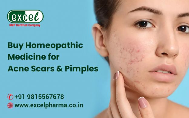 Are you tired of relentless acne scars & pimple problems? Then, opt for Homeopathic medicine for
