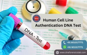 Human Cell Line Authentication Test in India can be a crucial decision, provided the significance an