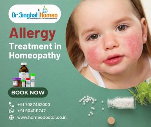 Allergy treatment in homeopathy is most recommended and effective for all types of allergies. Howeve