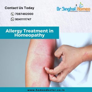 Dr. Singhal Homeo is among the best Homeopathy clinics in Chandigarh to treat allergies and patients
