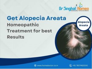 Alopecia Areata is an autoimmune disease where a person starts losing hair from one or more spots on