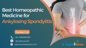 Are you looking for the best Ankylosing spondylitis treatment in Homeopathy? Then, you are at the ri
