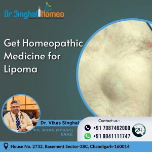 Lipomas are a type of benign, i.e., non-cancerous tumors, chiefly made up of fat cells. However, Hom
