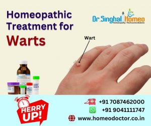 Warts is a skin infection caused by the human papillomavirus (HPV). It can be transmitted sexually a