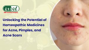 Are you tired of persistent acne or pimple problems? No need to worry! Homeopathy is the best soluti