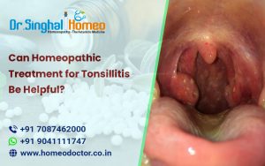 If you are looking for an effective, safe, and long-lasting alternative to treat recurrent tonsillit