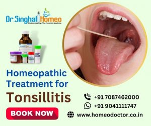 Homeopathic Treatment for Tonsillitis problem is one of the best options available today for treatme