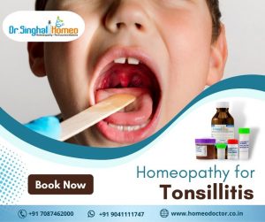 Our health is affected directly by the amount of unhealthy food we consume on a daily basis. Tonsill